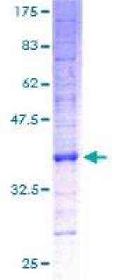 SDS-PAGE: Recombinant Human ATP synthase C mature GST (N-Term) Protein [H00000516-P01]