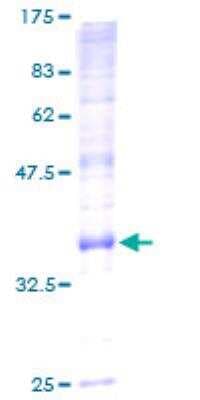 SDS-PAGE: Recombinant Human ATP5G2 GST (N-Term) Protein [H00000517-P01]