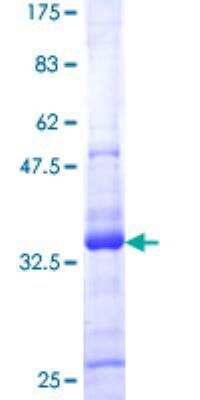 SDS-PAGE: Recombinant Human ATRX GST (N-Term) Protein [H00000546-P01]