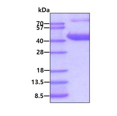SDS-PAGE: Recombinant Human Aldolase B His Protein [NBP1-99113]