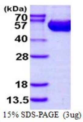 SDS-PAGE: Recombinant Human Argininosuccinate Lyase His Protein [NBP1-72510]