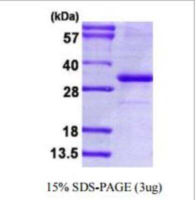 SDS-PAGE: Recombinant Human PD-L1 His Protein [NBP1-98984]