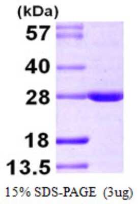 SDS-PAGE: Recombinant Human BAG2 His Protein [NBP1-51025]