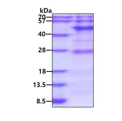 SDS-PAGE: Recombinant Human BCKDHA His Protein [NBP1-51018]