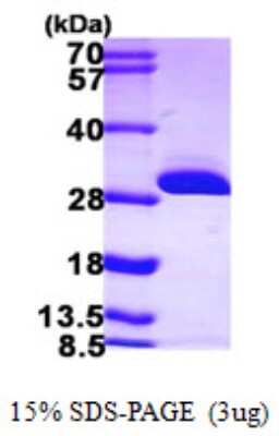 SDS-PAGE: Recombinant Human BDH2 His Protein [NBP1-50963]