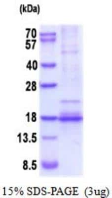 SDS-PAGE: Recombinant Human BDNF His Protein [NBP2-52006]