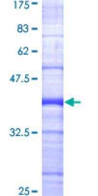 SDS-PAGE: Recombinant Human BIK GST (N-Term) Protein [H00000638-Q01]