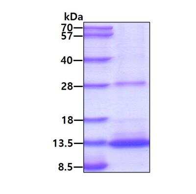 SDS-PAGE: Recombinant Human BMP-2 Protein [NBC1-19057]