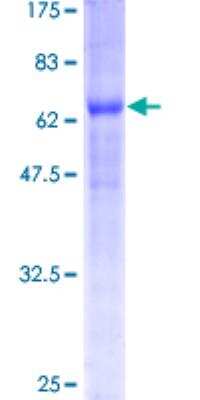 SDS-PAGE: Recombinant Human BNIP2 GST (N-Term) Protein [H00000663-P01]