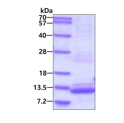 SDS-PAGE: Recombinant Human BRICK1 His Protein [NBP2-51529]
