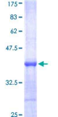 SDS-PAGE: Recombinant Human BTK GST (N-Term) Protein [H00000695-Q01]