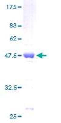 SDS-PAGE: Recombinant Human Bax GST (N-Term) Protein [H00000581-P01]