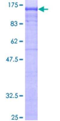 SDS-PAGE: Recombinant Human Beta 2 Adaptin GST (N-Term) Protein [H00000163-P01]