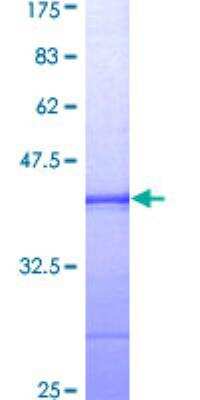 SDS-PAGE: Recombinant Human Bub1 GST (N-Term) Protein [H00000699-Q01]