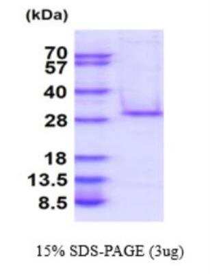 SDS-PAGE: Recombinant Human C1qTNF5/CTRP5 His Protein [NBP2-77501]