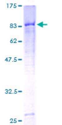 SDS-PAGE: Recombinant Human C4 binding protein A GST (N-Term) Protein [H00000722-P01]