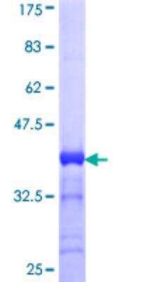SDS-PAGE: Recombinant Human CACNA1S GST (N-Term) Protein [H00000779-Q01]