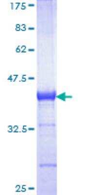 SDS-PAGE: Recombinant Human CBS GST (N-Term) Protein [H00000875-Q01]