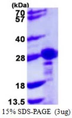 SDS-PAGE: Recombinant Human CBX1 His Protein [NBP1-72359]