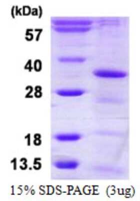 SDS-PAGE: Recombinant Human CCDC5 His Protein [NBP1-99034]