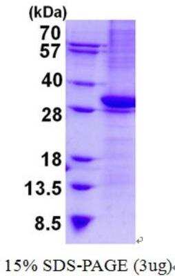 SDS-PAGE: Recombinant Human CD1b His Protein [NBP2-22744]
