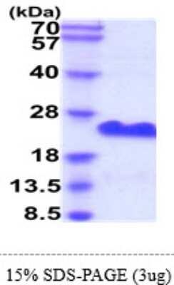 SDS-PAGE: Recombinant Human CD20 His Protein [NBP2-61455]