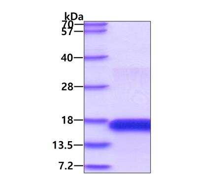 SDS-PAGE: Recombinant Human CD3 epsilon His Protein [NBP2-22752]