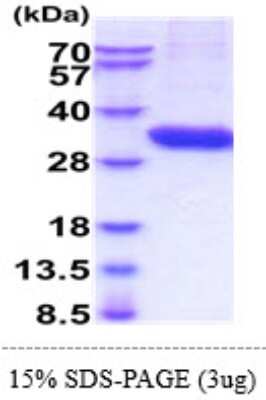 SDS-PAGE: Recombinant Human Tryptase alpha/beta 1 His Protein [NBP2-61189]