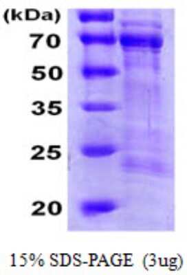 SDS-PAGE: Recombinant Human CDC25A His Protein [NBP1-51019]