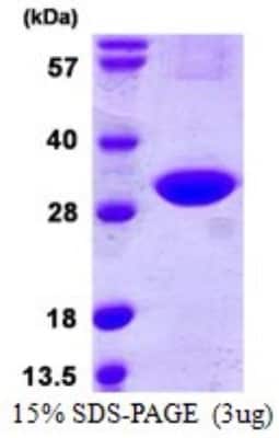 SDS-PAGE: Recombinant Human CINP His Protein [NBP1-72364]