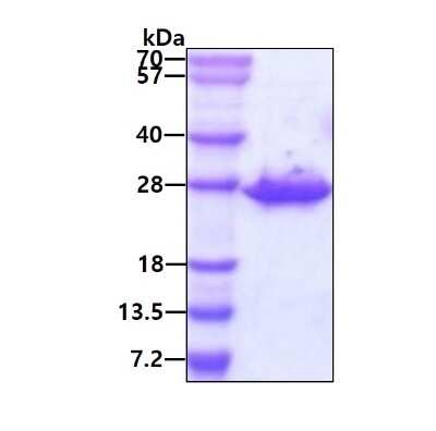 SDS-PAGE: Recombinant Human CLPP Protein [NBP1-72319]