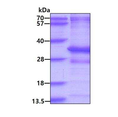 SDS-PAGE: Recombinant Human CNOT8 His Protein [NBP2-22743]