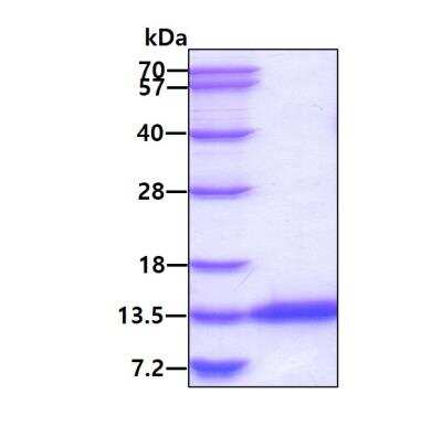 SDS-PAGE: Recombinant Human CRIP1 His Protein [NBP2-22979]