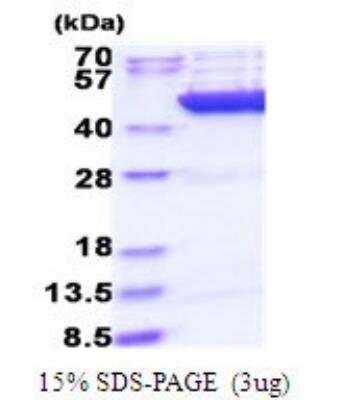 SDS-PAGE: Recombinant Human CS Citrate Synthase His Protein [NBP2-51818]