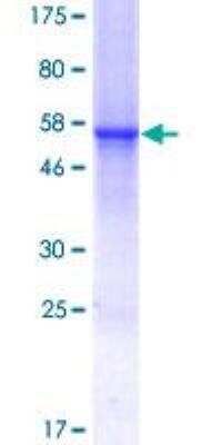 SDS-PAGE: Recombinant Human CTRP7 GST (N-Term) Protein [H00114905-P01]