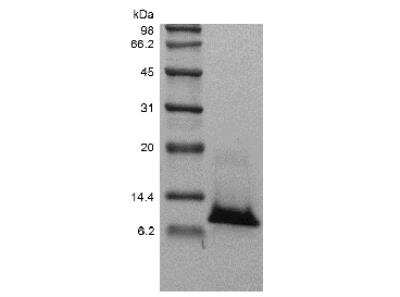 SDS-PAGE: Recombinant Human CXCL8/IL-8 Protein [NBP2-34907]