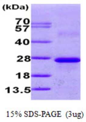 SDS-PAGE: Recombinant Human Calneuron 1 His Protein [NBP1-50858]