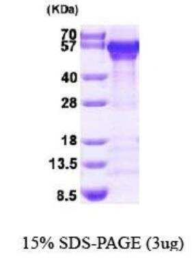 SDS-PAGE: Recombinant Human Calreticulin His Protein [NBP1-44499]