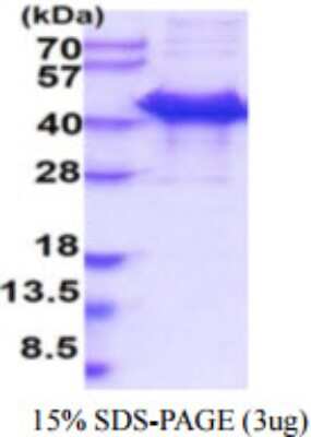 SDS-PAGE: Recombinant Human Calumenin Protein [NBP2-59930]