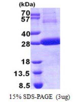 SDS-PAGE: Recombinant Human Cathepsin F His Protein [NBP2-22739]