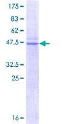 SDS-PAGE: Recombinant Human Caveolin-1 GST (N-Term) Protein [H00000857-P01]