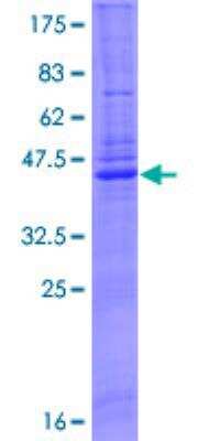 SDS-PAGE: Recombinant Human Caveolin-3 GST (N-Term) Protein [H00000859-P01]
