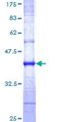 SDS-PAGE: Recombinant Human Caveolin-3 GST (N-Term) Protein [H00000859-Q01]