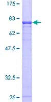 SDS-PAGE: Recombinant Human Cbl-c GST (N-Term) Protein [H00023624-P01]