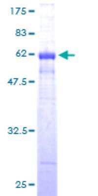 SDS-PAGE: Recombinant Human Cyclin D1 GST (N-Term) Protein [H00000595-P01]