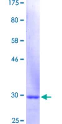 SDS-PAGE: Recombinant Human Cytokeratin 3 GST (N-Term) Protein [H00003850-Q01]