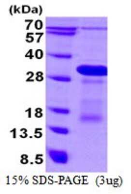SDS-PAGE: Recombinant Human DBNDD1 His Protein [NBP1-98889]