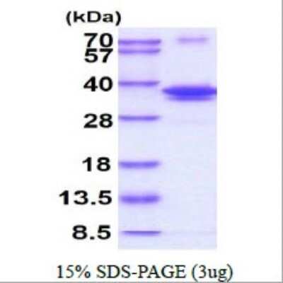 SDS-PAGE: Recombinant Human DNA Polymerase lambda His Protein [NBP1-72496]