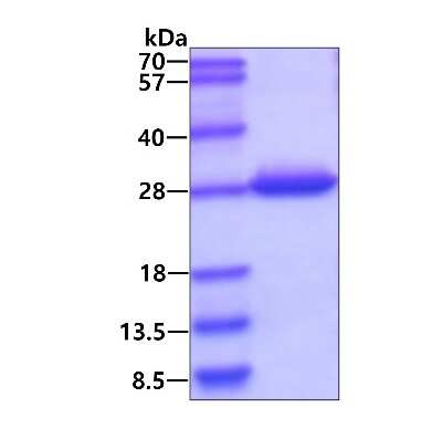 SDS-PAGE: Recombinant Human DTYMK His Protein [NBP1-72360]