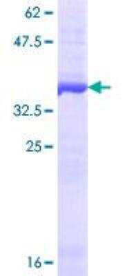 SDS-PAGE: Recombinant Human Drosha GST (N-Term) Protein [H00029102-Q01]